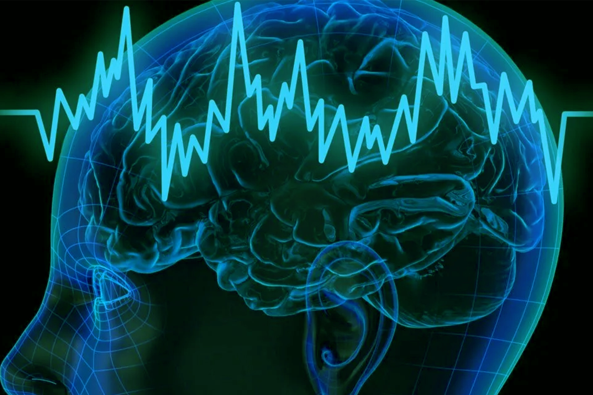 Overcoming Fear and Greed: Psychological Strategies for Forex Traders Overcoming Fear and Greed: Psychological Strategies for Forex Traders